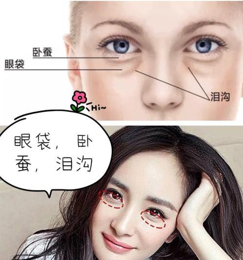 如何区分眼袋和卧蚕（有效方法帮你识别眼部问题，摆脱困扰）