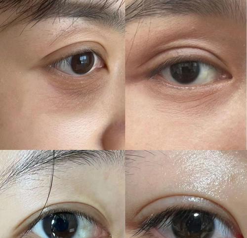 自然土方法去眼纹的有效措施（使用土方法去除眼纹，告别岁月痕迹）